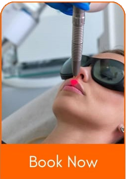 laser-treatment1