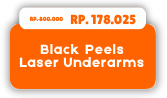 2-black-peels-laser-underams